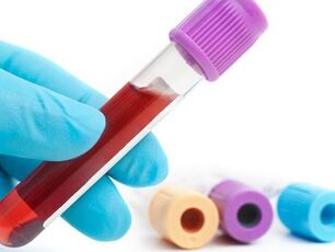 Laboratoriniai metodai