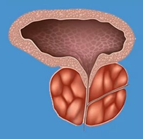 Būdingi požymiai prostatitas