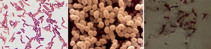 E. coli, fekalinis enterokokas ir proteus yra pagrindiniai lėtinio bakterinio prostatito sukėlėjai