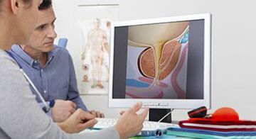 diagnozuojant vyro prostatitą